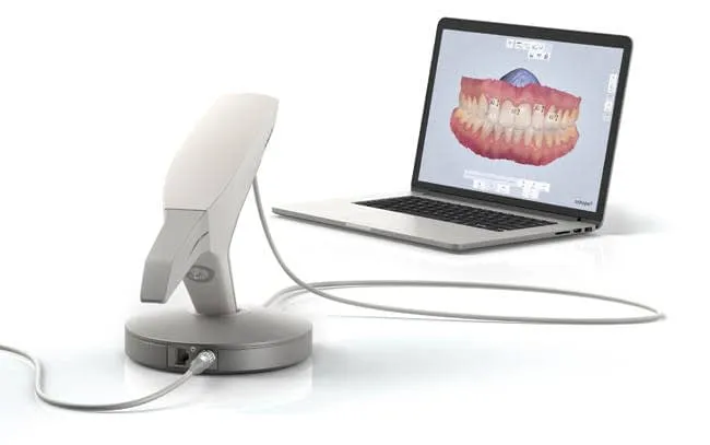 Escáner intraoral Trios 3Shape conectado a un ordenador en la Clínica Dental Lijó